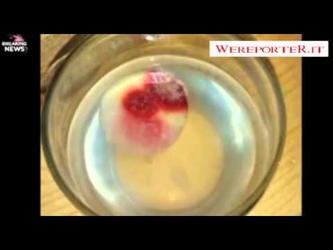 La ricetta di decolorazione per la persona La crema da pigmentary nota mirakl kl