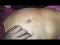 Nabhi Dharan Nabhi Samasya Massage Trending Viralvideo