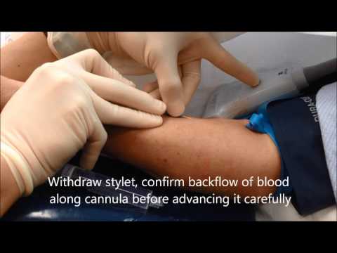 Essential guide to ultrasound-guided intravenous (IV) cannulation