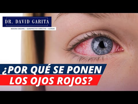 ¿Por qué se ponen rojos los Ojos?