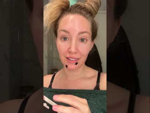 Trying StarFace Pimple Patches!