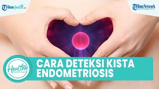 Cara Deteksi Kista Endometriosis pada Wanita, Simak Usalan dr Arie Sutanto