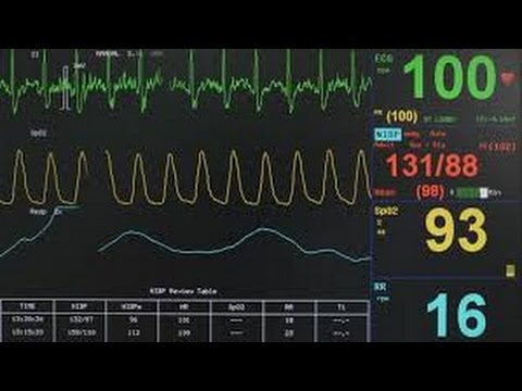 Matixu x Emyej - Bije serce ( prod. Bonifacy ) VIDEO MASH-UP