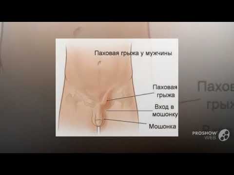 Санатории липецка лечение позвоночника Точки при грудном остеохондрозе