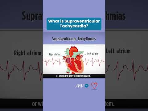 What is Supraventricular Tachycardia?
