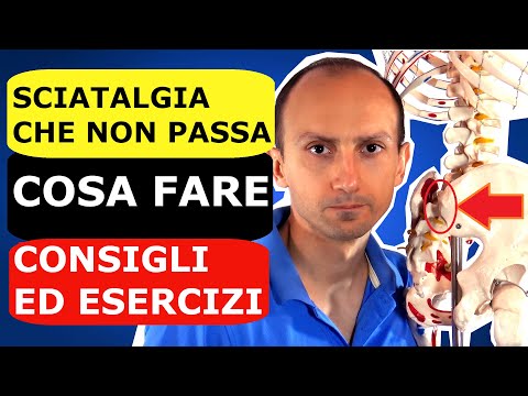 Sciatalgia: Perché non Passa, Cosa Fare, i Consigli e gli Esercizi Utili