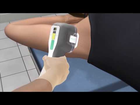 miraDry - How It Works Animation