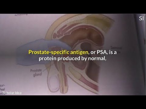 Prostatitis Fiatal okokból