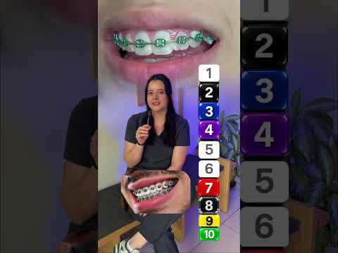 Colores Ortodoncia #dentista #bracket #teeth #dentist #orthodontist #braces #dentistry #ortodoncia