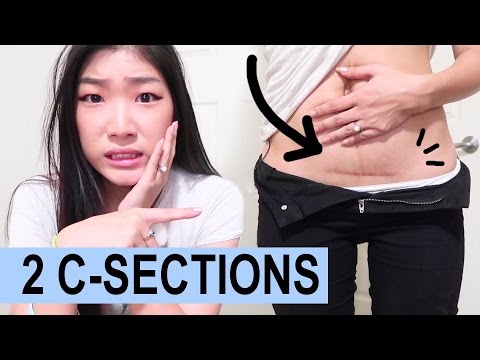 Mawalan ng timbang fractional kapangyarihan Sa ganitong paraan upang mawalan ng timbang na kailangang mag-video
