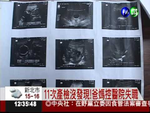 11次產檢沒發現! 男嬰胸前多條腿