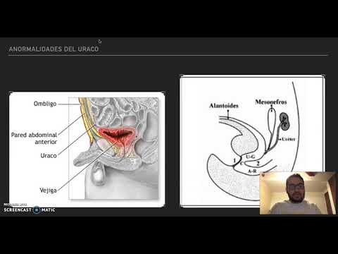 reabilitarea dupa limba lead varicoza
