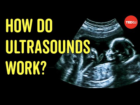 Fascinating Science - How Ultrasound Works