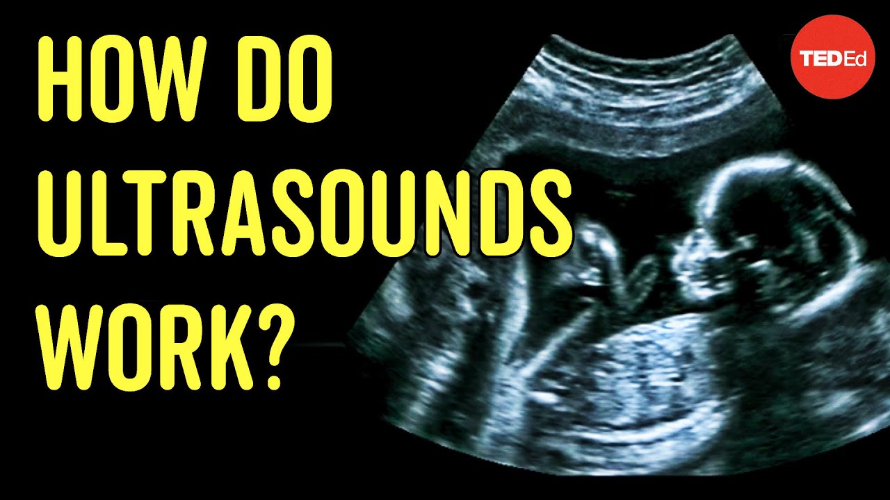 How does ultrasound work? - Jacques S. Abramowicz