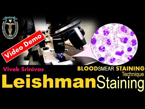 LEISHMAN STAINING | Blood Smear Staining Technique | Microbiology | Vivek Srinivas | #Bacteriology