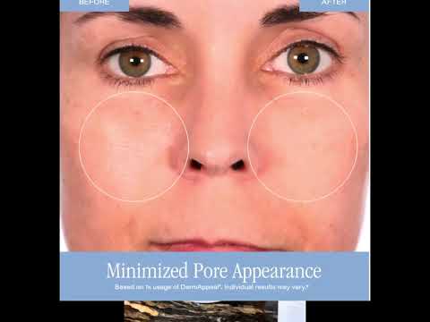 Why DermAppeal Sells Every 60 Seconds! (You NEED to Try This) ✨