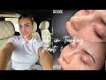 Nose Job In Turkey Vlog Part 2 Going To A Turkish Hamam Nose Reveal