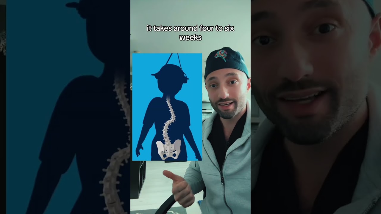 This is how we treat cases of severe scoliosis in the spine.