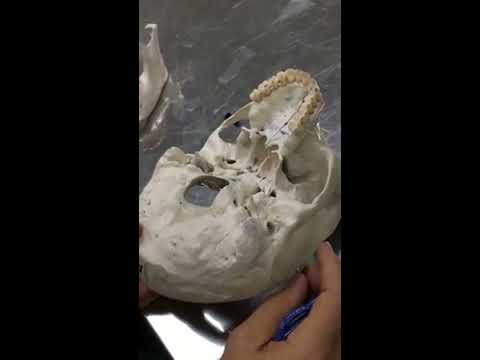 Practical osteology  5 ( skull , norma  basalis externa ), by Dr. Wahdan