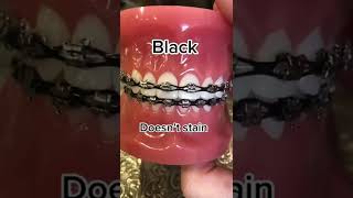 Most Popular Braces Colors 🌈❤️