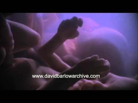 Twins Interacting In the Womb 4