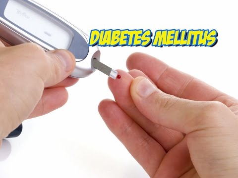 Diabetes Mellitus | krankheitslehre | Pflege Kanal