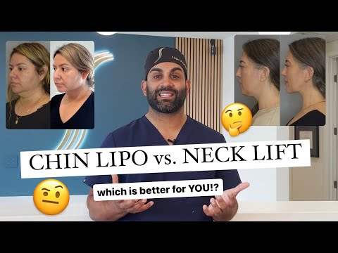 Chin Lipo Vs. Deep Neck Lift.. which is better for YOU!?