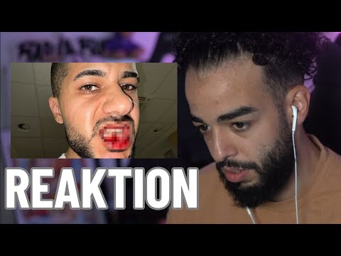 HAMEDS JAW BROKEN....SAMI REACTION green