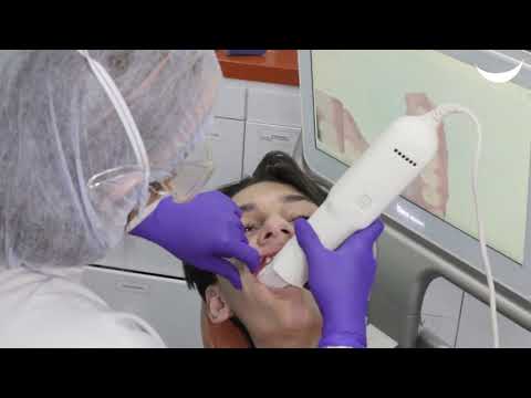 Ortodoncia Invisaling