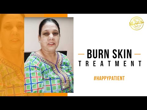 Burn Skin Treatment | Patient Testimonial | Dr. Nivedita Dadu's Dermatology Clinic