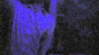 Sex Bruises - Denton TX 1/13/11