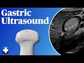 Gastric Ultrasound Gastric POCUS