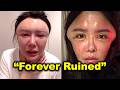 China's "Bubble Face" Trend Is Destroying Lives