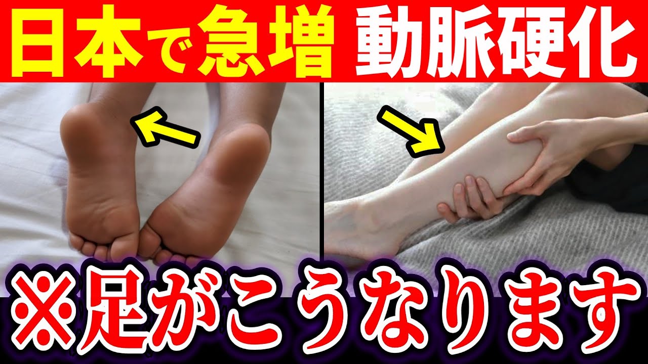 足の血管が詰まる直前に出る5つの危険サイン、必ずこうなります