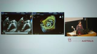 Quantification of mitral regurgitation – Dr Lisa Simmons