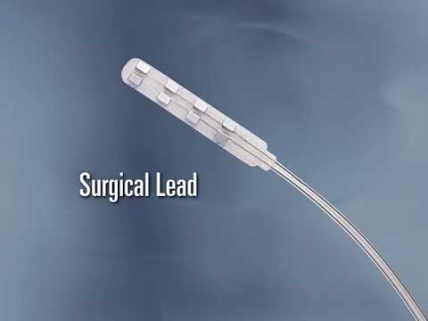 Dr. Georgios Matis - Neuromodulation - Spinal Cord Stimulation - Instructional video - Introduction