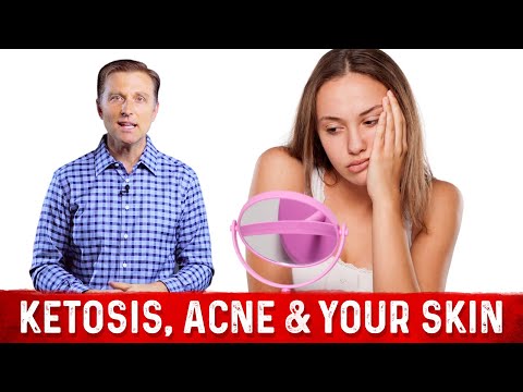 What is a Ketone Explained By Dr Berg