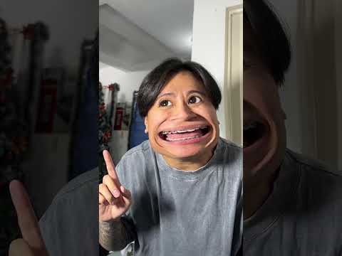 Recipe for disaster🥶😰📱#BiboyBecky #BiboyAndBecky #shorts #skits #funny #comedy