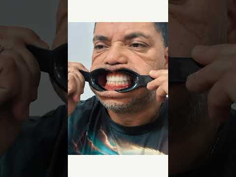 Logo of ALL ON 4 DENTAL IMPLANTS