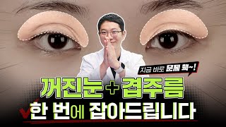 꺼진눈, 겹주름 한 번에 해결하기 위한 방법! | 티에스성형외과
