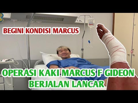 Operasi Kaki Marcus Fernaldi Gideon The Minions Berjalan Lancar