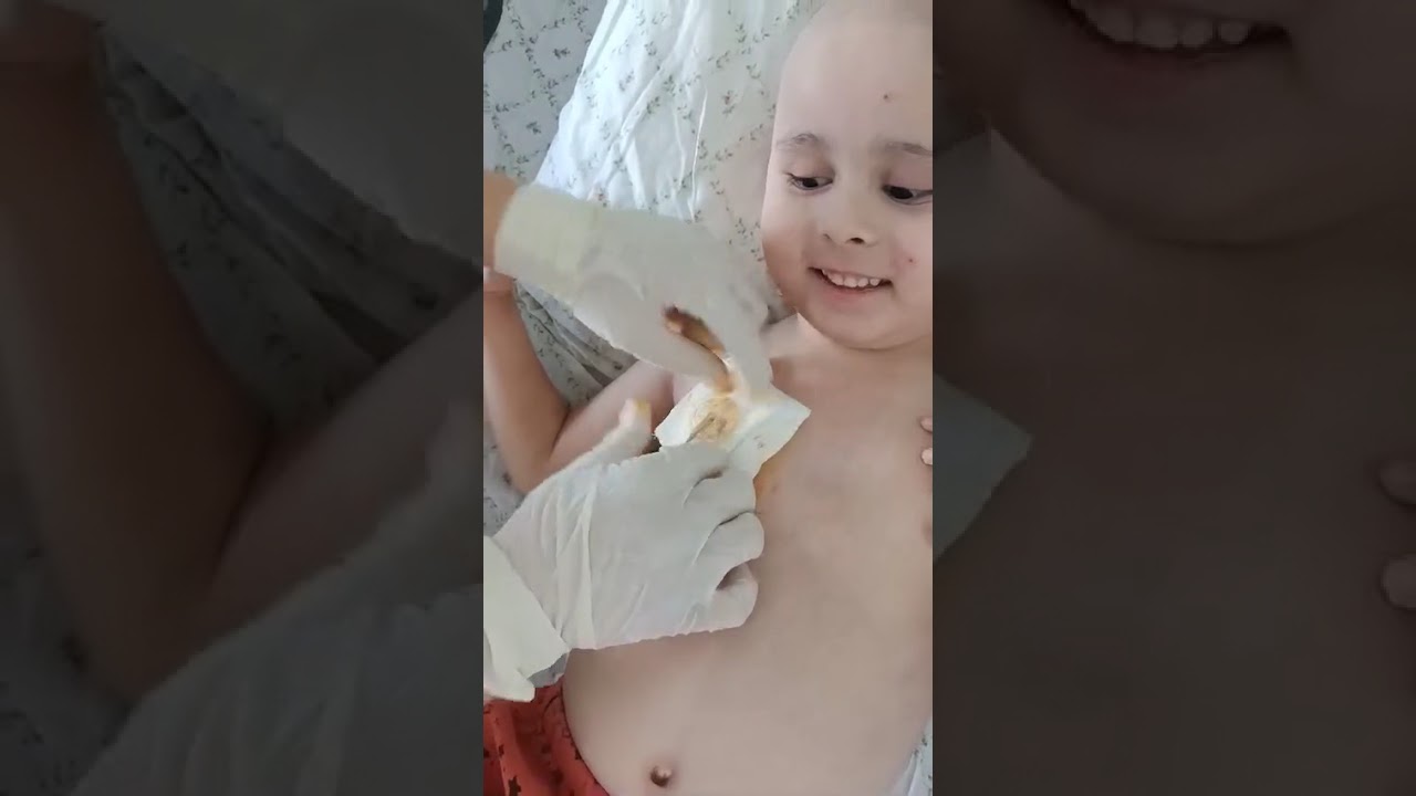 Port Pansumanı Nasıl Yapılır?