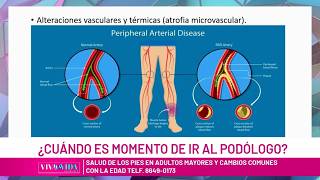 ¿Cuándo es momento de ir al Podólogo?