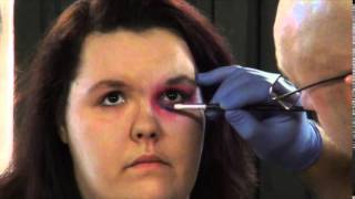 Stage Makeup Bruises