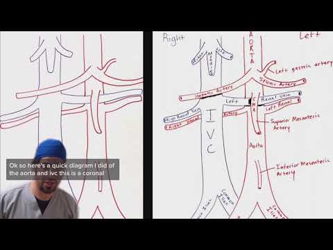 Aorta and IVC breakdown for ultrasound