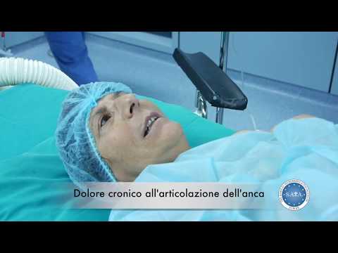 Che si applicano quando giunto gonfio Anti-infiammatori per il dolore alla schiena