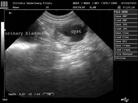 prostatic cyst?