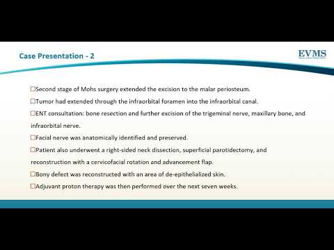 Thumbnail image of video presentation for A Distinctive Histological Form of Squamous Cell Carcinoma with Perineural Invasion
