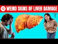 LIVER is DYING 12 Weird Signs of LIVER DAMAGE | liver cirrhosis | fatty liver signs you should know