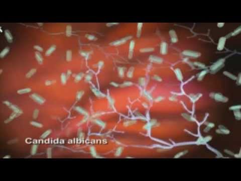 Mycose Vaginale -- Définition Et Causes